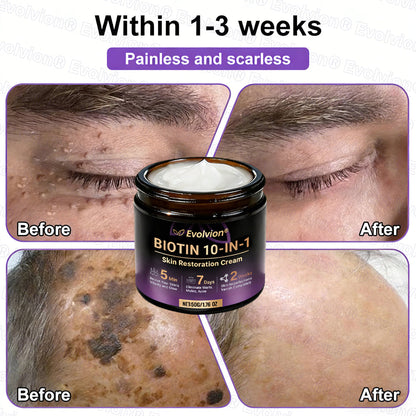 Made and Shipped from Australia ✨Evolvion® Biotin 10-in-1 Skin Restoration Cream🌻