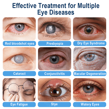 Rekulo® OptiMist Eye Spray✅For dry eyes, blurry vision, eye strain, presbyopia, and cataracts👁️