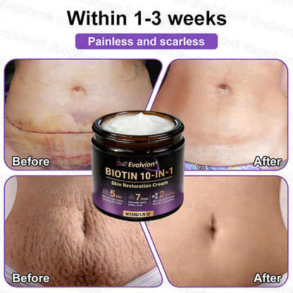 Made and Shipped from Australia ✨Evolvion® Biotin 10-in-1 Skin Restoration Cream🌻