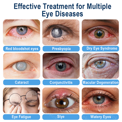 Rekulo® OptiMist Eye Spray✅For dry eyes, blurry vision, eye strain, presbyopia, and cataracts👁️ up