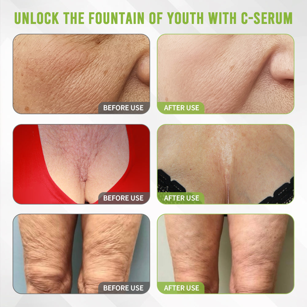 👩‍⚕️Rolimey® Kakadu Plum Skin Repair Serum ✅️ TGA Approved | Infused with PDRN Collagen for Eliminating Wrinkles, Stretch Marks, Age Spots