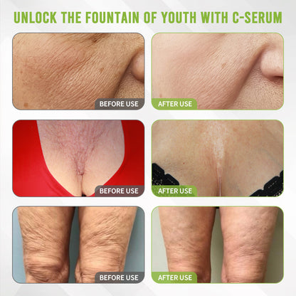 👩‍⚕️Rolimey® Kakadu Plum Skin Repair Serum ✅️ TGA Approved | Infused with PDRN Collagen for Eliminating Wrinkles, Stretch Marks, Age Spots
