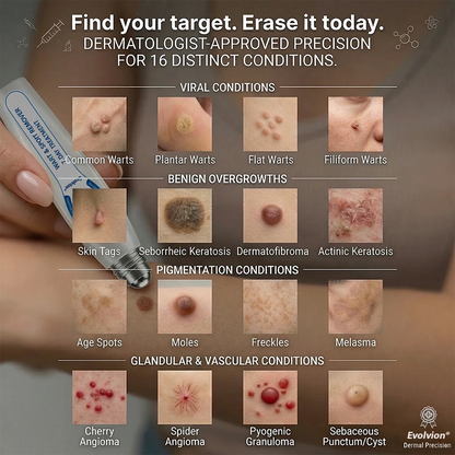 ✨Evolvion® 𝟕-𝐃𝒂𝘆 𝐒𝗸𝐢𝐧 𝐓𝒂𝗴 & 𝐒𝐩𝙤𝐭 𝐄𝐫𝒂𝐬𝙚𝐫 Painless & Scar-Free Advanced Imperfection Remova𝗜 Ro𝗜𝗜erba𝗜𝗜 Pen upsell