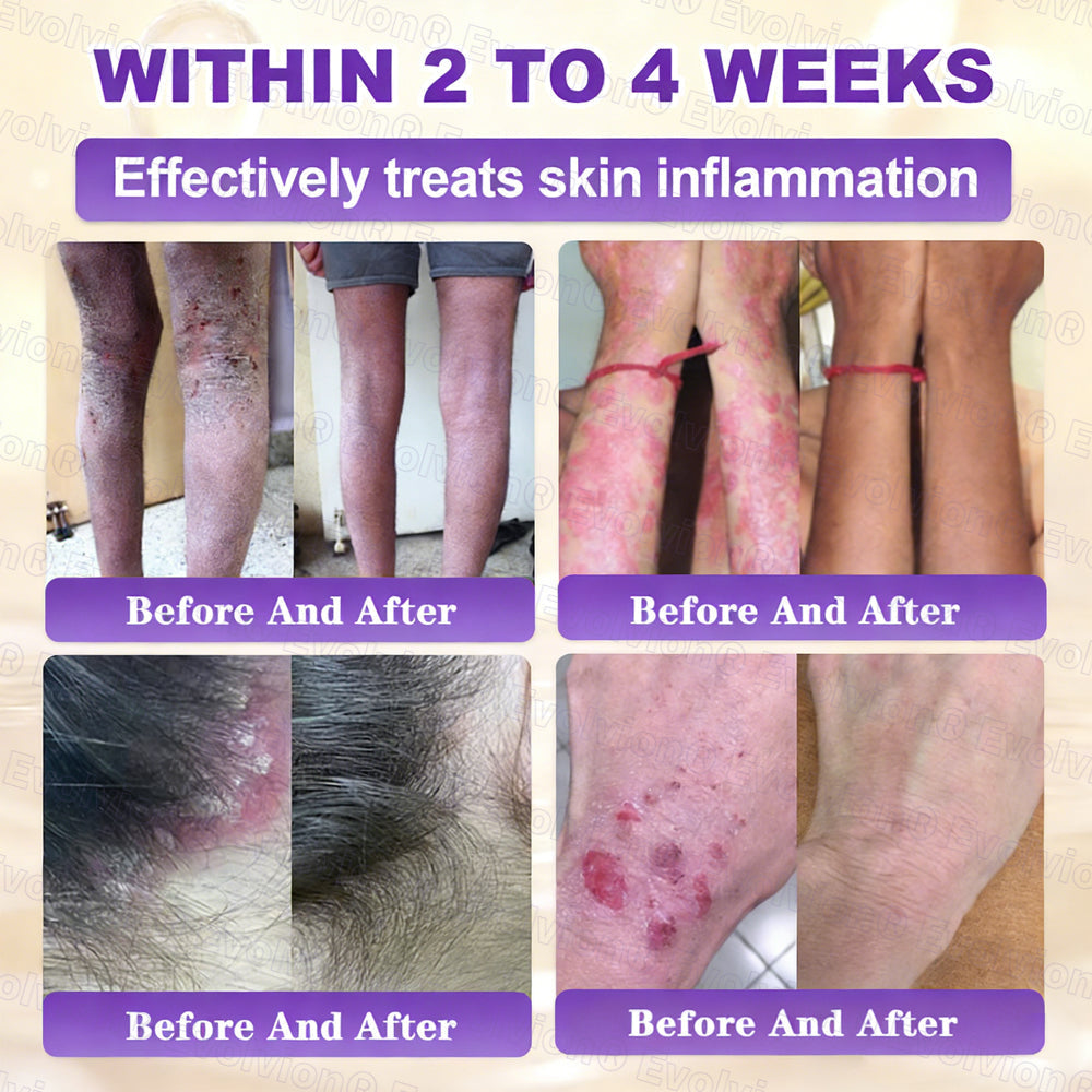 Made and Shipped from Australia ✨Evolvion® Biotin 10-in-1 Skin Restoration Cream🌻