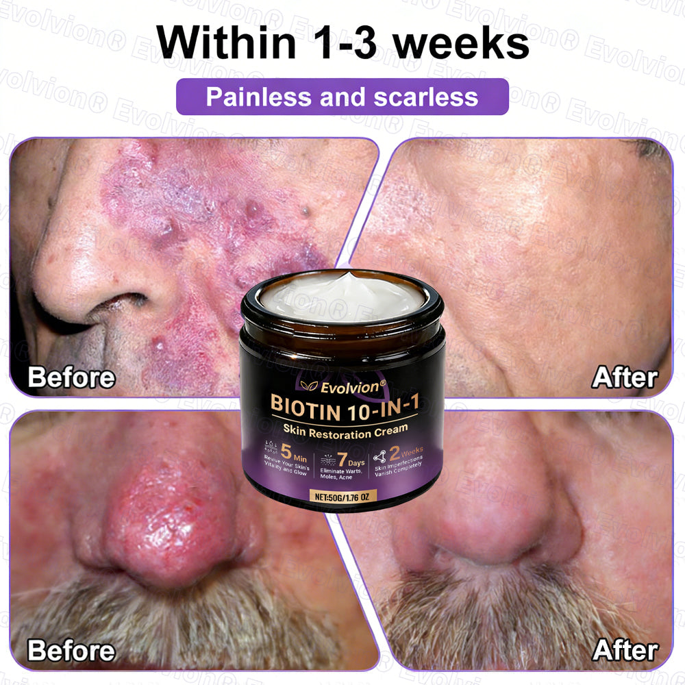 Made and Shipped from Australia ✨Evolvion® Biotin 10-in-1 Skin Restoration Cream🌻