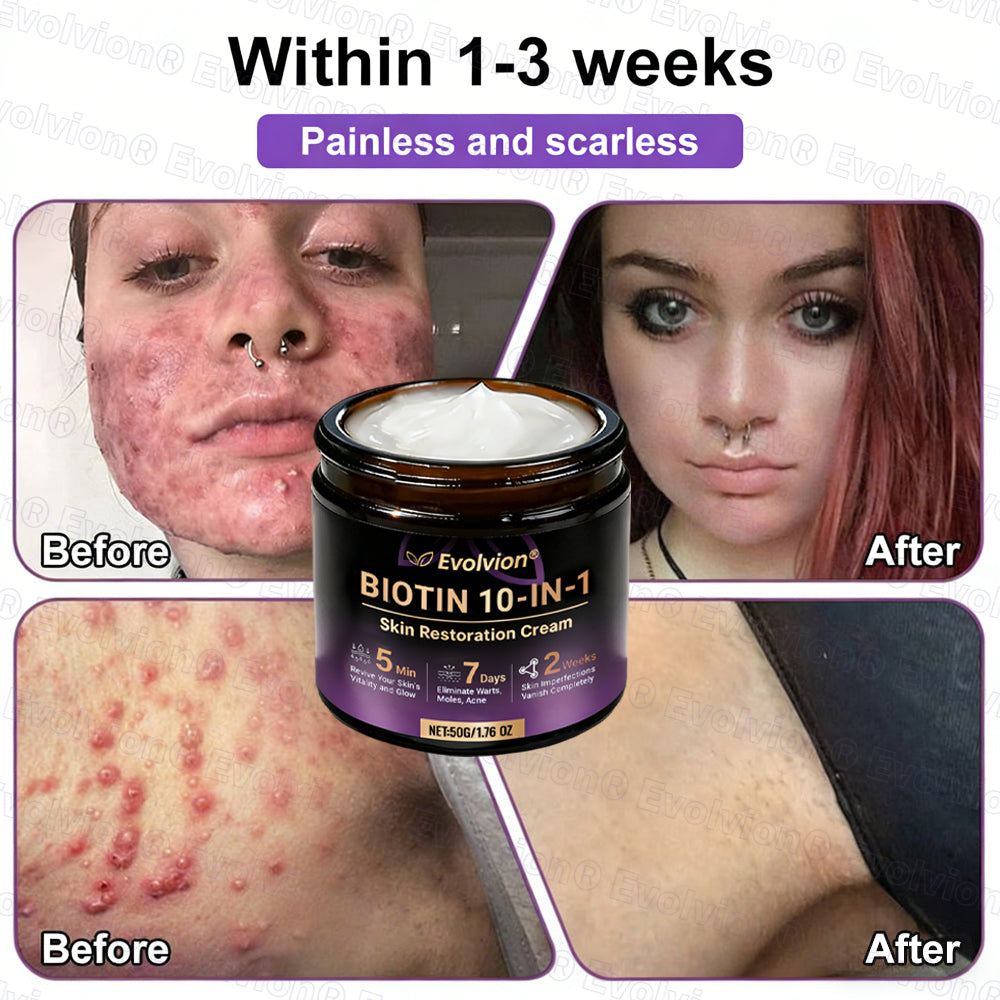 Made and Shipped from Australia ✨Evolvion® Biotin 10-in-1 Skin Restoration Cream🌻